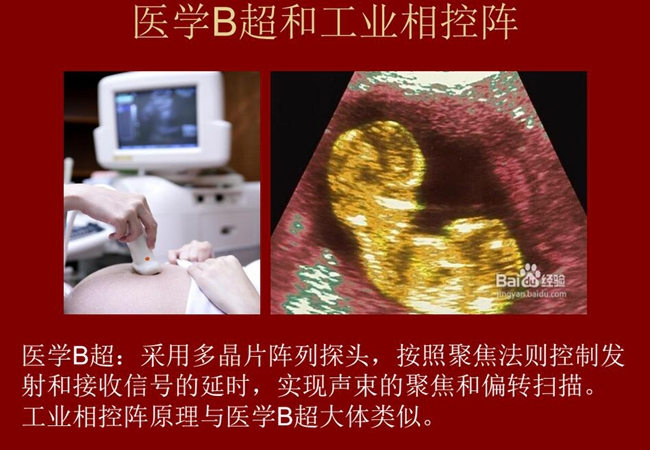 工業(yè)相控陣原理與醫(yī)學B超大體類似，醫(yī)學B超采用多晶片陣列探頭，按照聚焦法則控制發(fā)射和接收信號的延時，實現(xiàn)聲束的聚焦和偏轉掃描